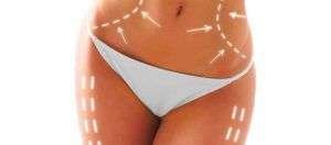 Cellulite Milano