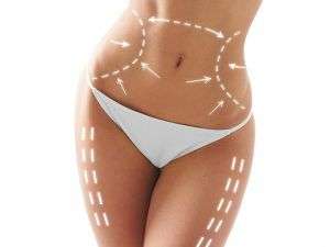 CELLULITE LUCCA