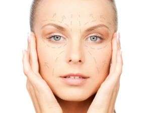 Filler acido ialuronico – Seregno