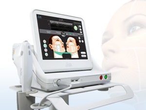 Ultherapy - Finesse - Cfu Elife