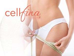 Trattamento anti cellulite Cellfina