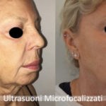 migliore viso a Forte dei Marmi e Milano