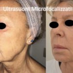migliore viso a Forte dei Marmi e Milano