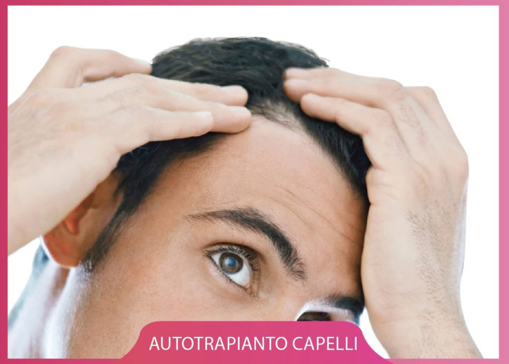 cellule staminali ricrescita capelli