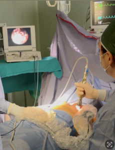 Mastoplastica di preservazione pre-pettorale