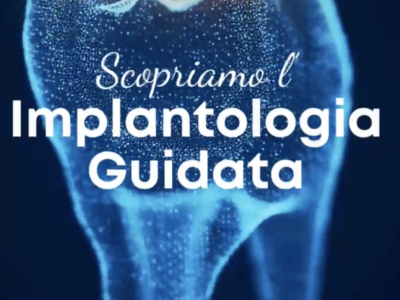 Implantologia mininvasiva guidata