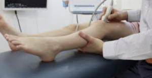 Fleboterapia Trap – Trattamento vene varicose