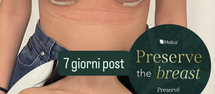 Mastoplastica Preservè Motiva a Seregno - Monza